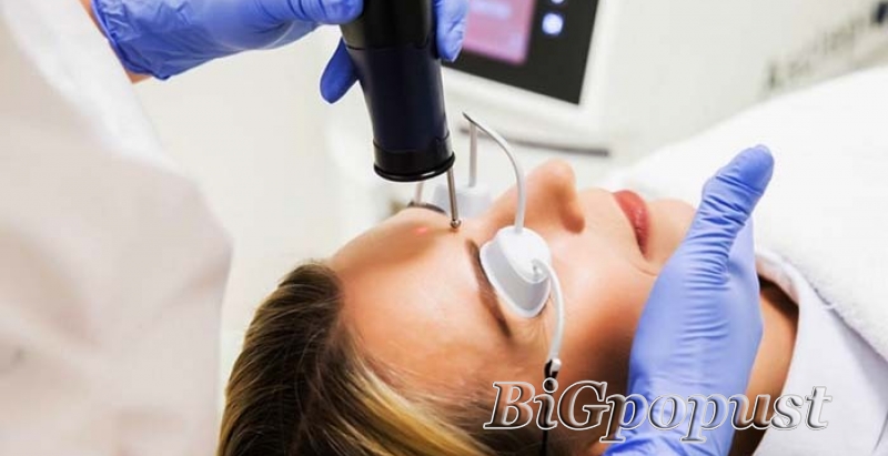 Tretman detox lica radiofrekvencijom + gratis ciscenje lica ultrazvucnom spatulom 1