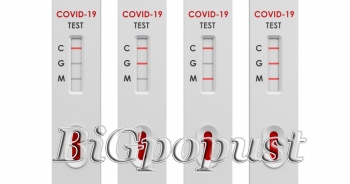 SARS Cov2 - ukupna antitela na COVID (IgM+IgG) - 2800 rsd