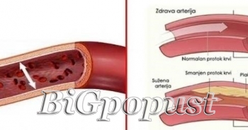 4200 rsd sistematski pregled krvnih sudova (dopler krvnih sudova ruku, nogu, vrata) 