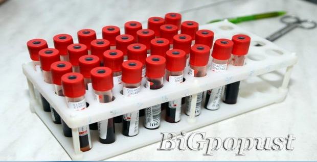 200 rsd za analizu kompletne krvne slike u laboratoriji Lin Lab 2