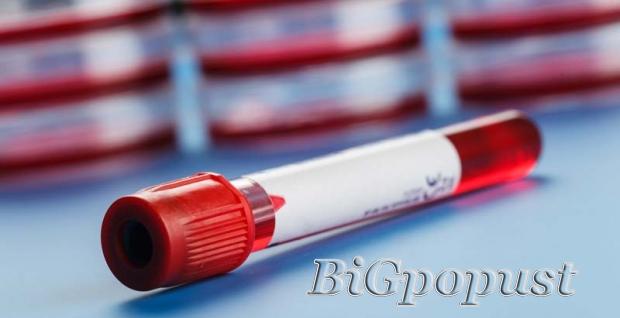 200 rsd za analizu kompletne krvne slike u laboratoriji Lin Lab 1