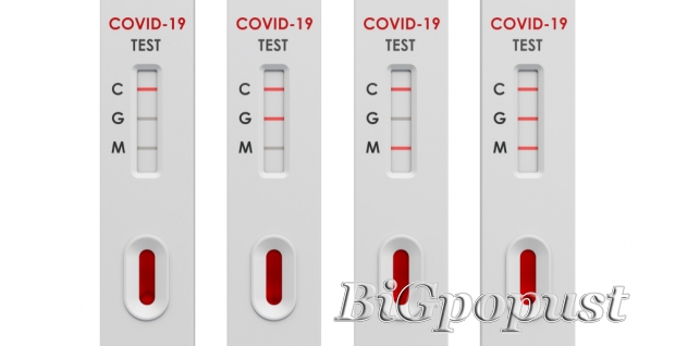 SARS Cov2 - ukupna antitela na COVID (IgM+IgG) - 2800 rsd