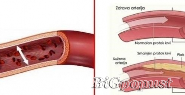4200 rsd sistematski pregled krvnih sudova (dopler krvnih sudova ruku, nogu, vrata) 