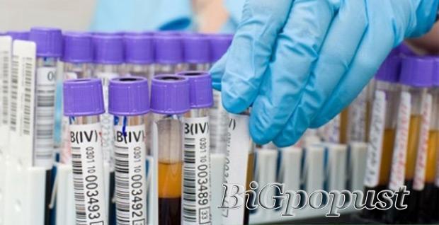 700 rsd biohemijska analizu krvi i urina u Laboratoriji LinLab 2