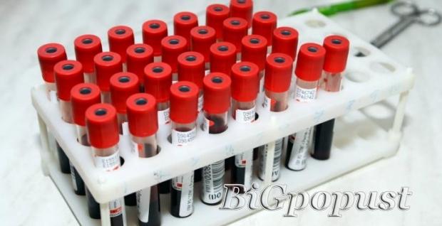 1499 rsd za kompletnu biohemijsku analizu krvi + besplatna konsultacija sa lekarom i tumacenje rezultata u laboratoriji City Lab 1
