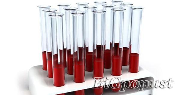 1499 rsd za kompletnu biohemijsku analizu krvi + besplatna konsultacija sa lekarom i tumacenje rezultata u laboratoriji City Lab 3