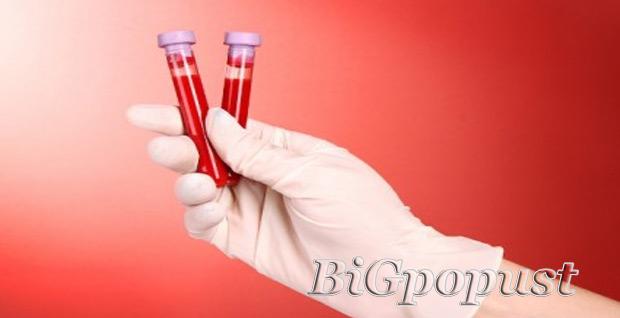 799 rsd za kompletnu biohemijsku analizu krvi + besplatna konsultacija sa lekarom i tumacenje rezultata u laboratoriji City Lab 4