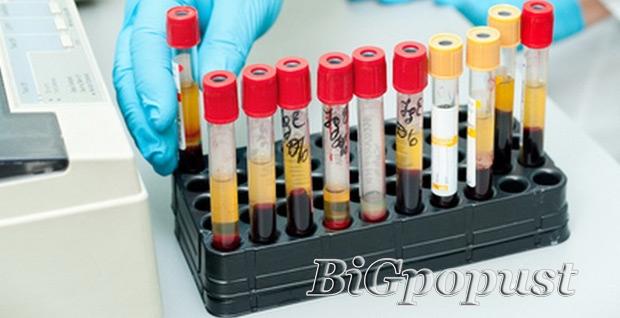990 rsd za kompletnu laboratorijsku analizu krvi i urina + besplatna konsultacija sa lekarom i tumacenje rezultata u laboratoriji City Lab 1