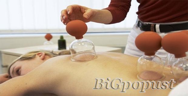 Cupping terapija (ventuza) - jedna od najstarijih metoda tradicionalne kineske medicine + masaza po izboru 2