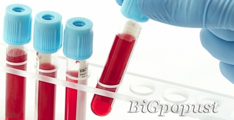 1000 rsd za analizu krvi i urina (kks, urea, creatinin, fe, glu, lipogram, ast, alt ,urin micro.) 4