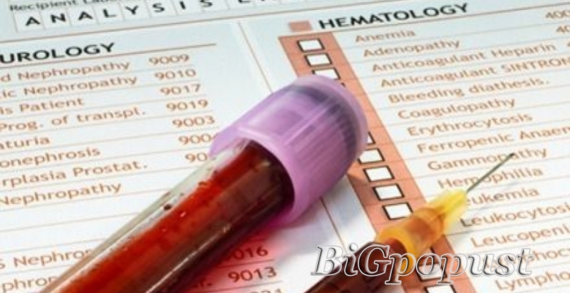 1000 rsd za analizu krvi i urina (kks, urea, creatinin, fe, glu, lipogram, ast, alt ,urin micro.) 3