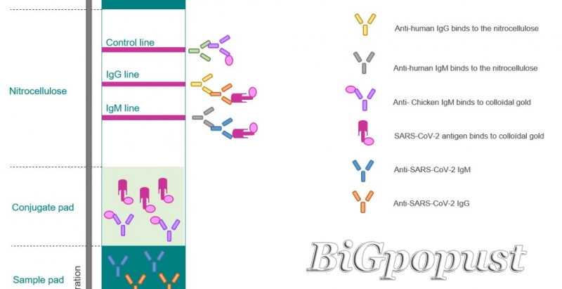 SARS Cov2 - ukupna antitela na COVID (IgM+IgG) - 2800 rsd 2
