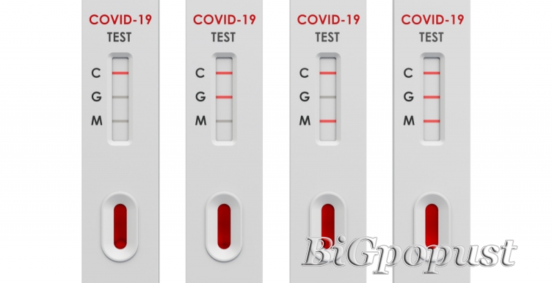 SARS Cov2 - ukupna antitela na COVID (IgM+IgG) - 2800 rsd 1