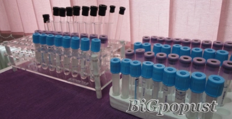 2990 rsd kompletna analiza polnih hormona - LH, FSH, PROLAKTIN, PROGESTERON, TESTOSTERON, ESTRADIOL 3