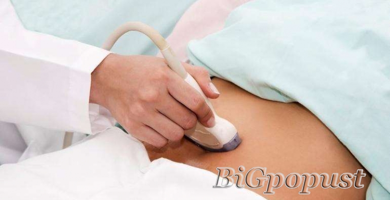 4100 rsd Sistematski ginekološki pregled (pregled,ginekološki UZ, PAPA, kolposkopija + cervikalni i vaginalni bris sa antibiogramom) 1