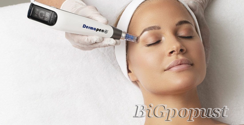  4800 rsd DERMAPEN (90 MINUTA) 4