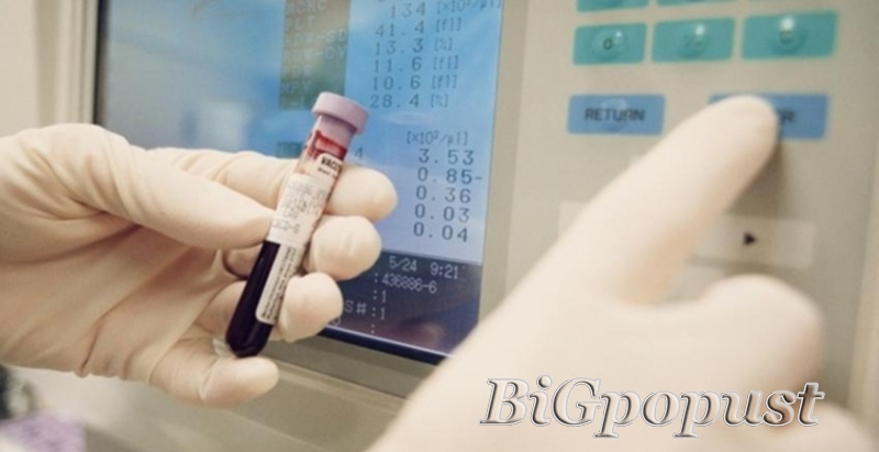 psa over 100 prognosis