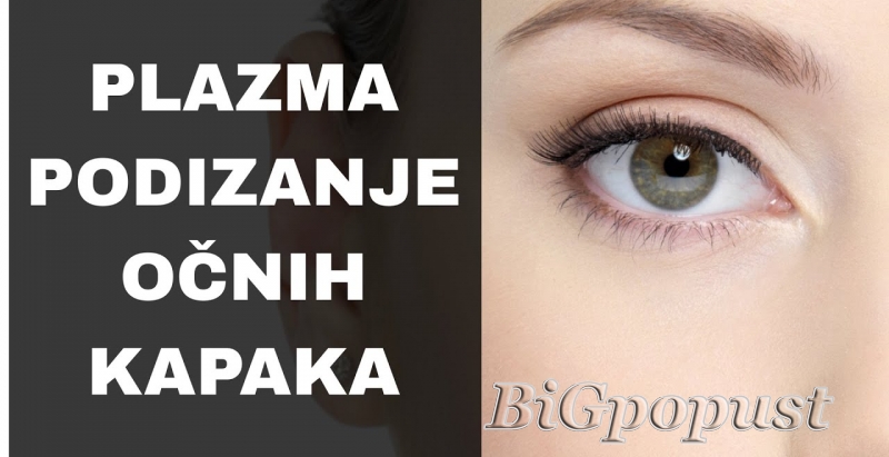 6000 rsd za tretman Plazma pen lifting - REZULTATI VIDJIVI ODMAH: zategnuta koža i vidljivo plice bore 1