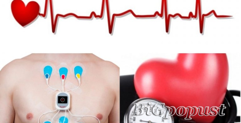 Holter 2 u 1 (holter EKG-a i krvnog pritiska u jednom nošenju) 5000 rsd 2