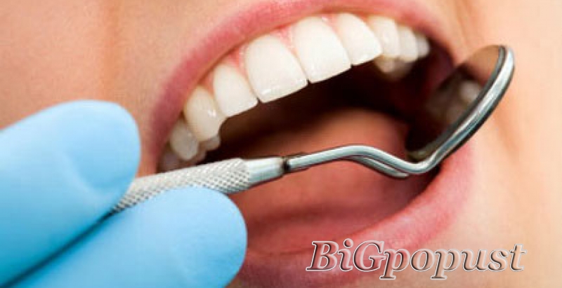 Ordinacijsko izbeljivanje zuba u stomatološkoj ordinaciji Dr D. Lopicic po promo ceni od 10000 rsd za obe vilice 1