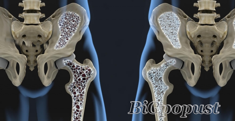 OSTEOPOROZA PANEL: Kalcijum. fosfor, paratiroidni hormon (PTH) i vitamin D3 2