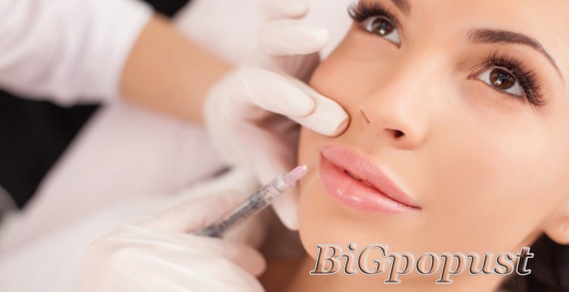 Popunjavanje usana hijaluronom 0,50ml za 8000 rsd u ordinaciji Dental Estetic (Beograd na vodi) 1