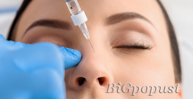 Reoblikovanje nosa hijaluronskim filerima 0.50ml za 8000 rsd u ordinaciji Dental Estetic (Beograd na vodi) 1